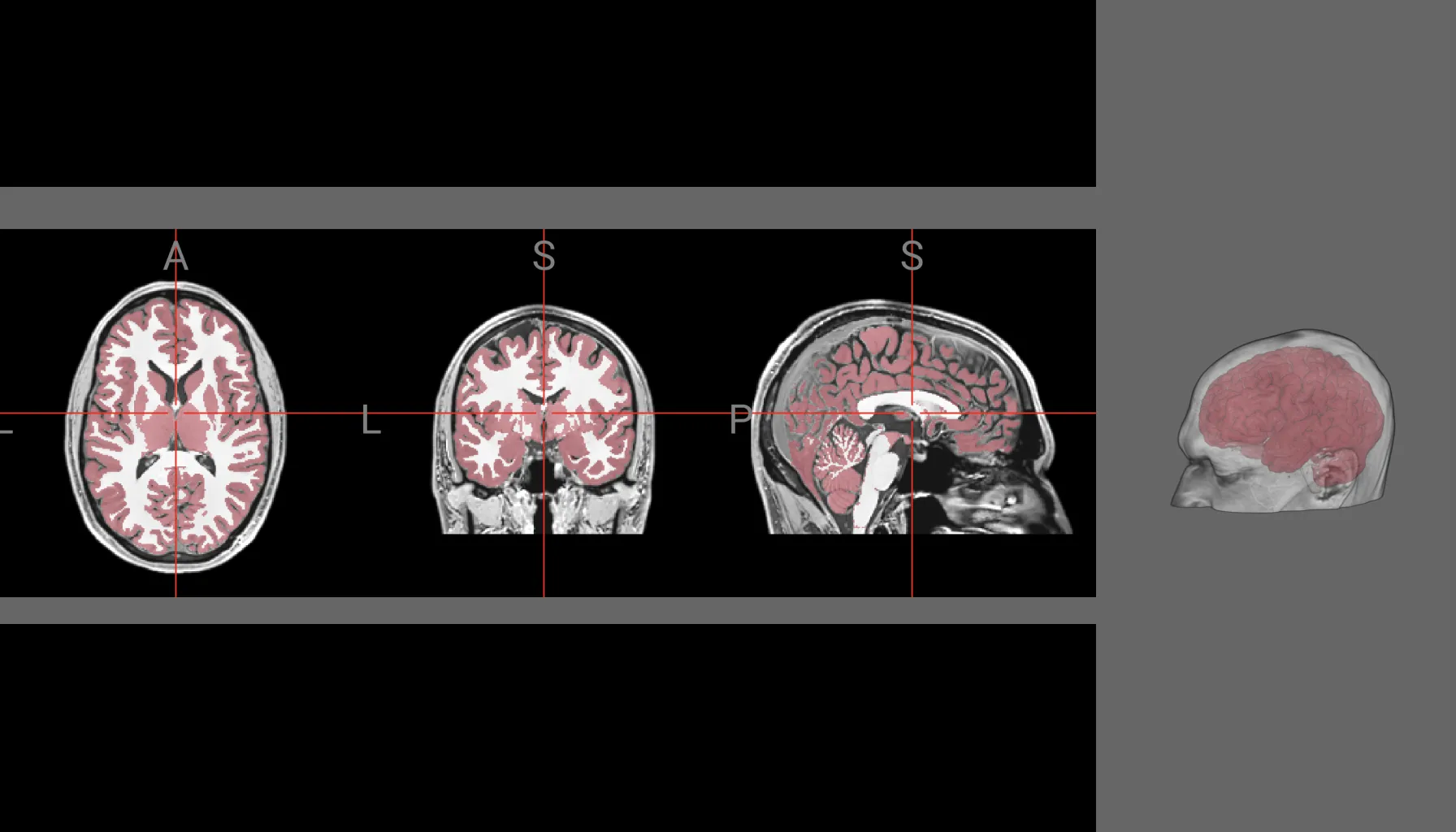 WebGPU-based brain scan visualization